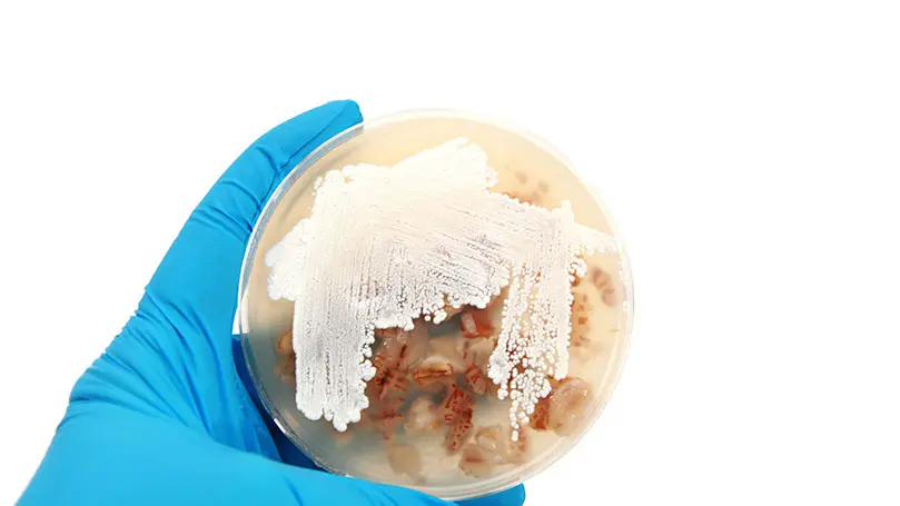 Hand in blauem Gummihandschuh hält Petrischale mit Stepromyces-Kolonie