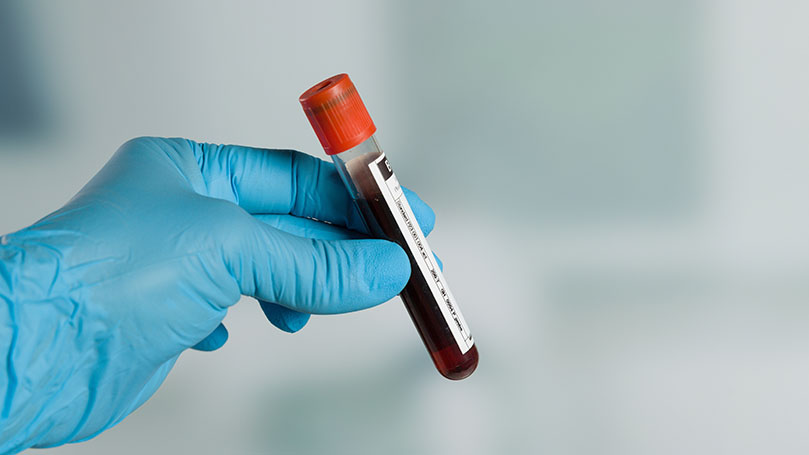 What exactly is sickle cell anemia?