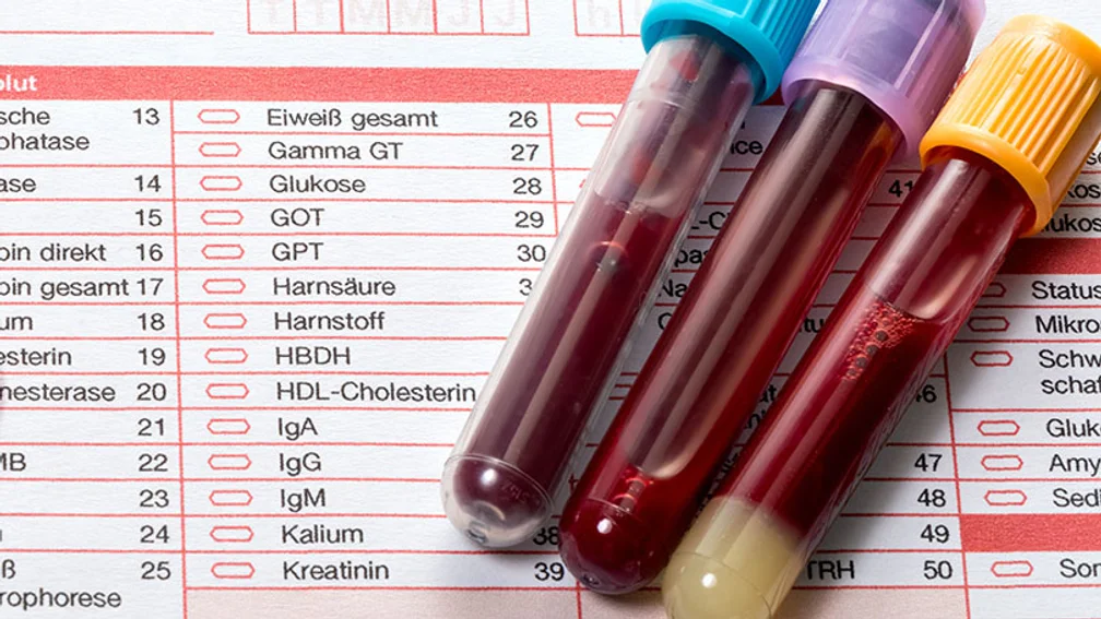Drei Röhrchen mit Blutproben liegen auf einem Laborformular