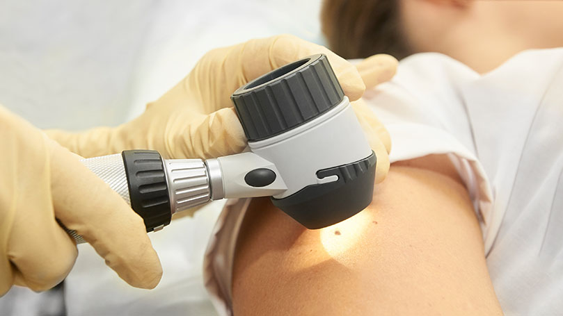 Melanoma: Why is it so dangerous?