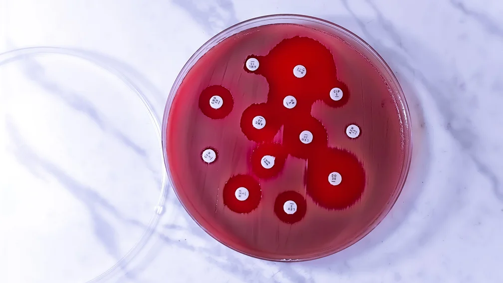 Petrischale mit Testung auf Antibiotikaresistenz