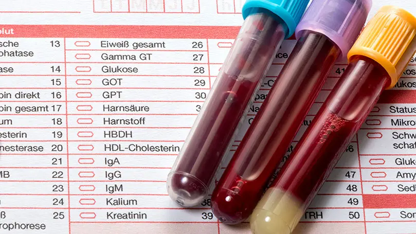 Drei Röhrchen mit Blutproben liegen auf einem Laborformular