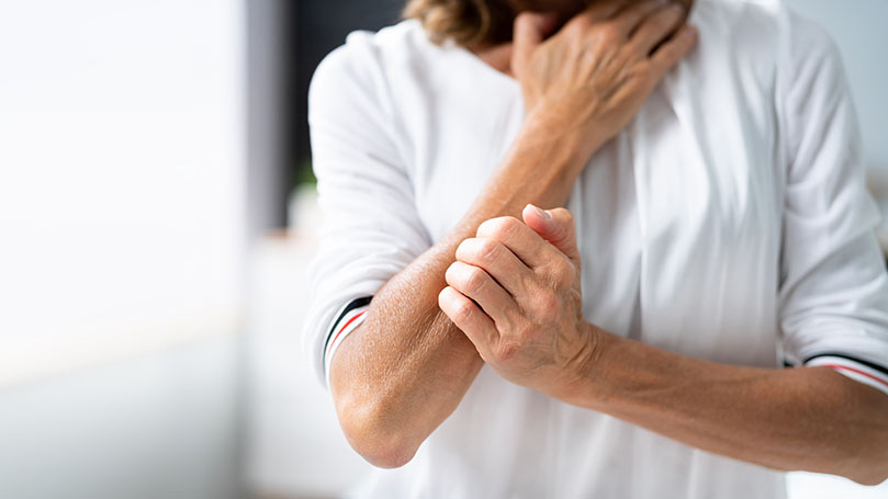 What exactly is Alpha-gal syndrome?